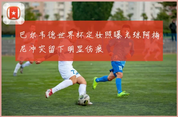 巴尔韦德世界杯定妆照曝光琼阿梅尼冲突留下明显伤痕